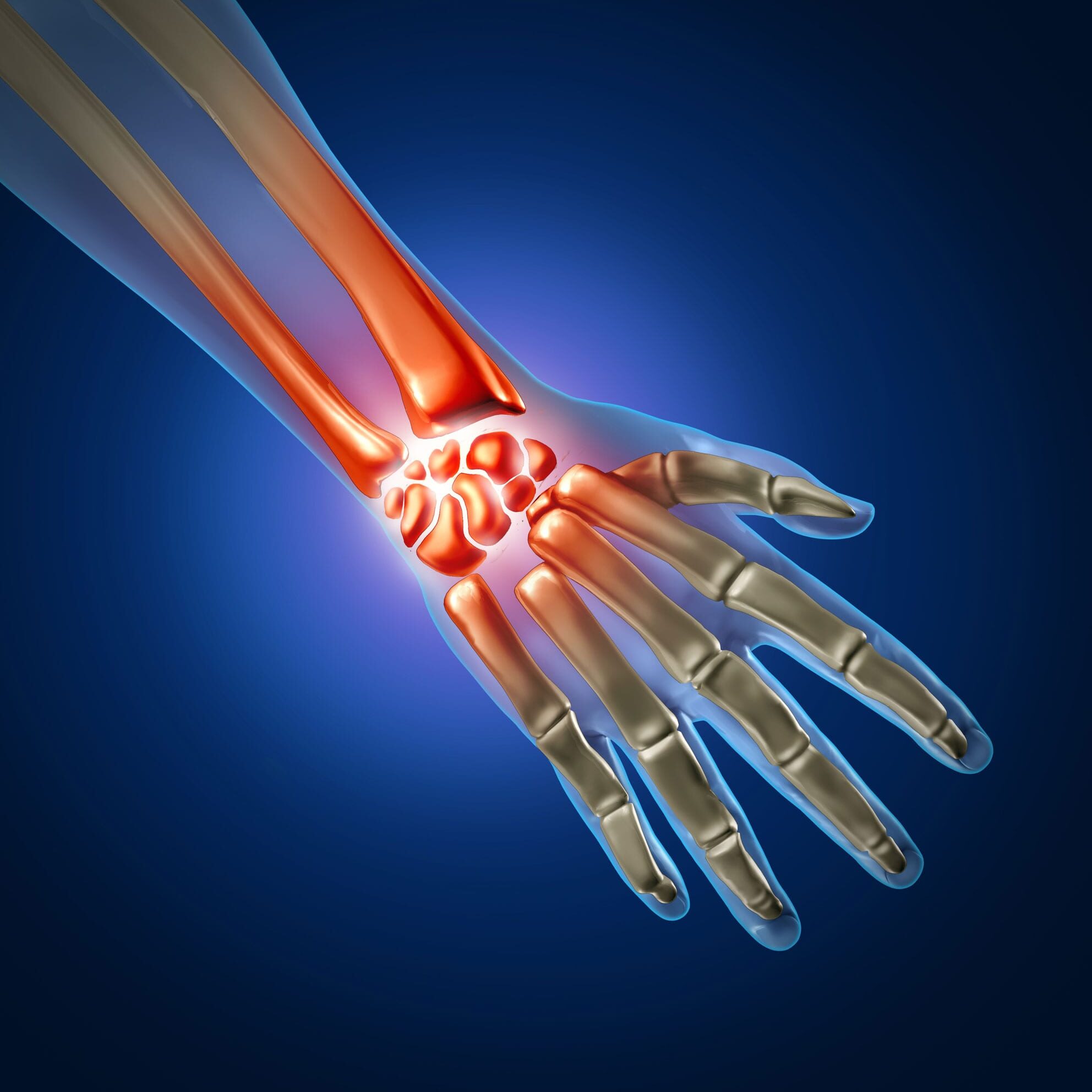 carpal-tunnel-syndrome-treatments_1984x2000